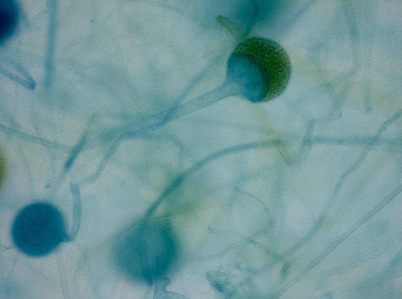 Zygomycota (Zigomiceti)